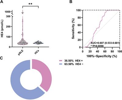 Increased serum human epididymis protein 4 is associated with disease activity and systemic involvement in pediatric-onset systemic lupus erythematosus